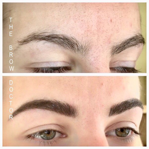 Before and After Micro-Blading Port Moody