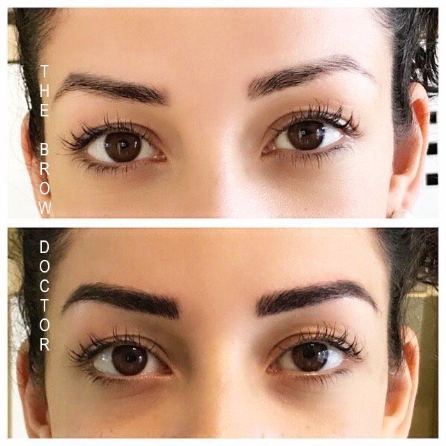 Before and After Micro-Blading White Rock