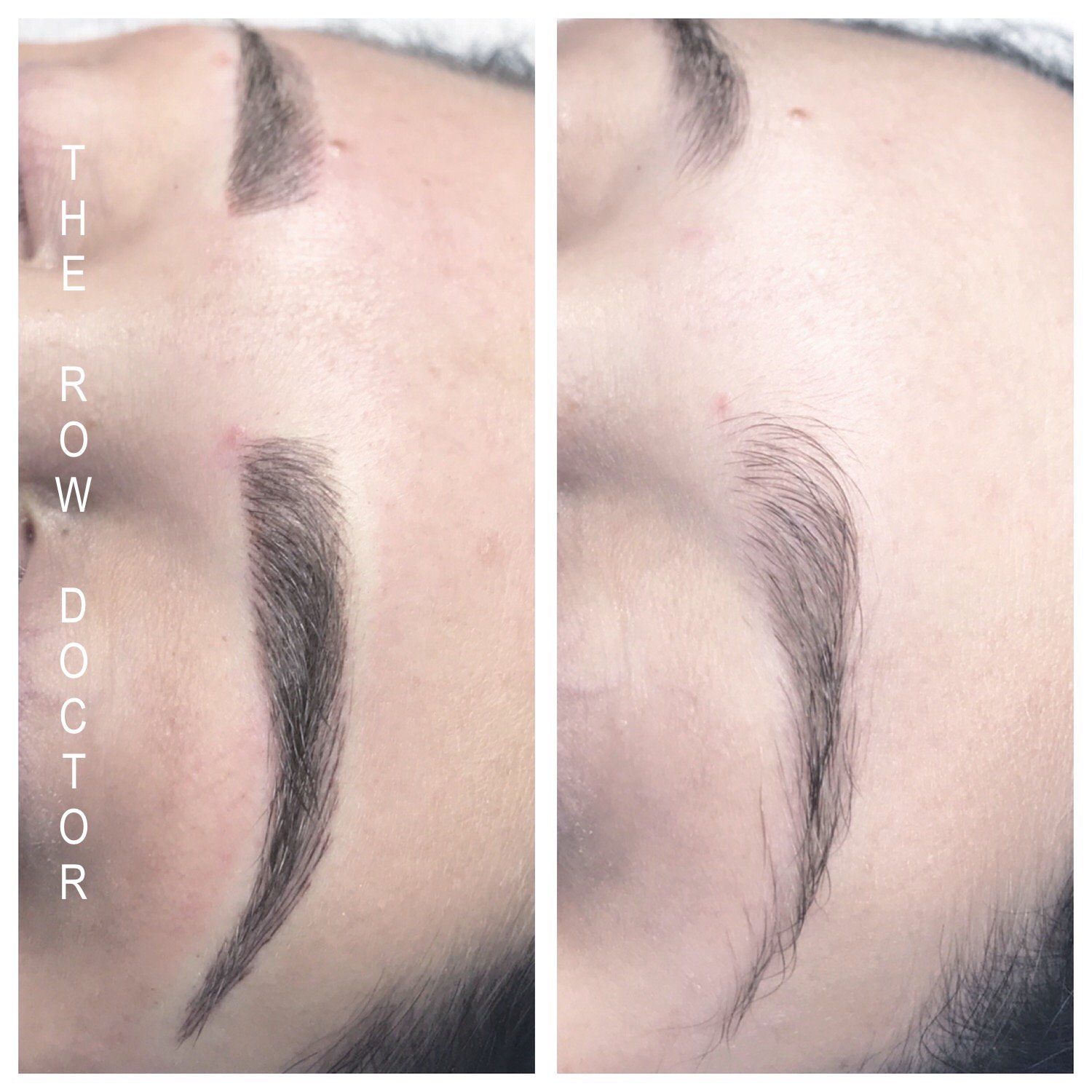 Before and After Micro-Blading