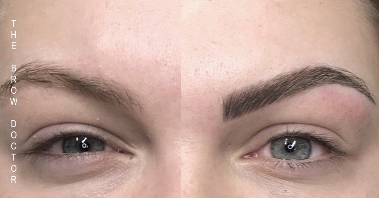 Before and After