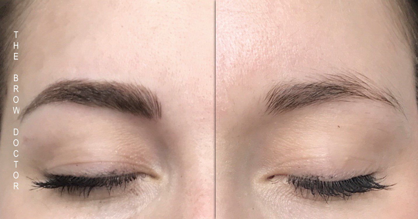 Before and After