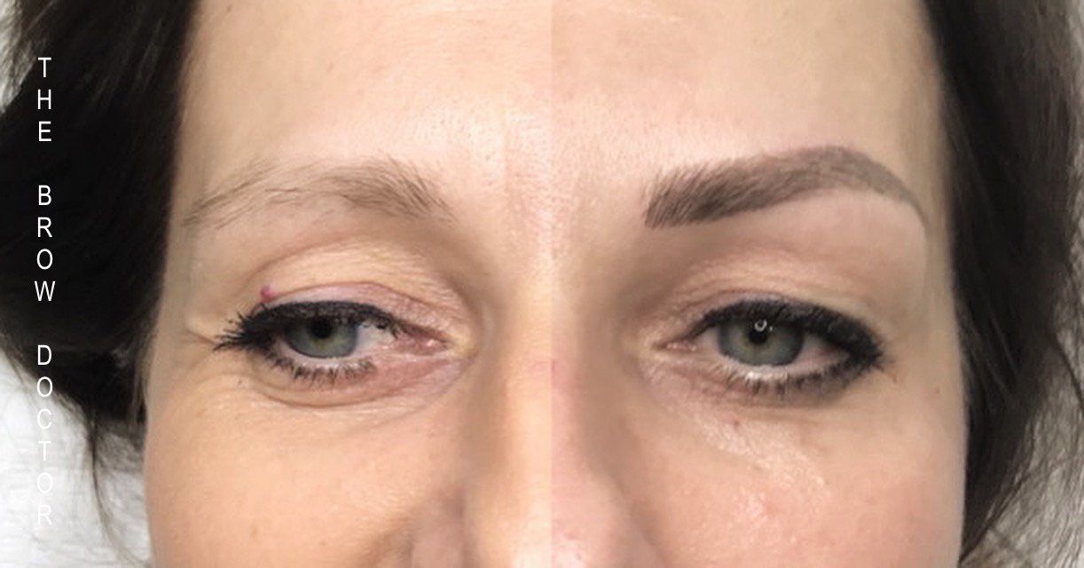 Before and After