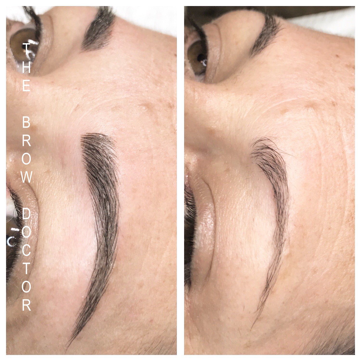 Before and After Micro-Blading