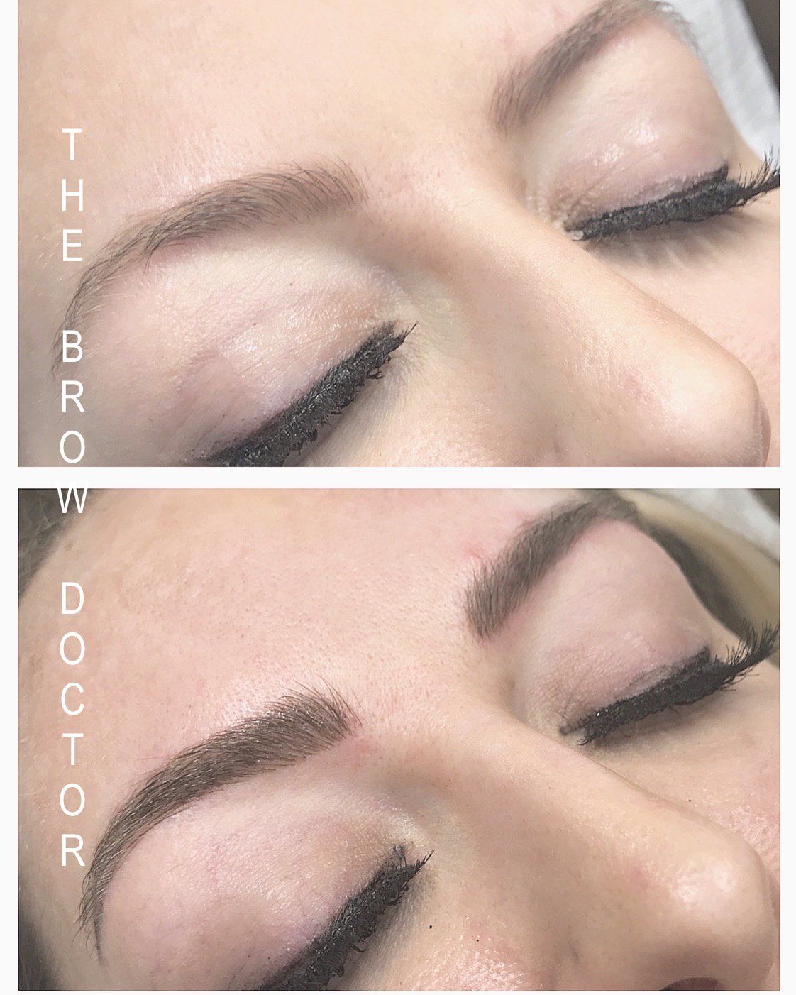 Before and After