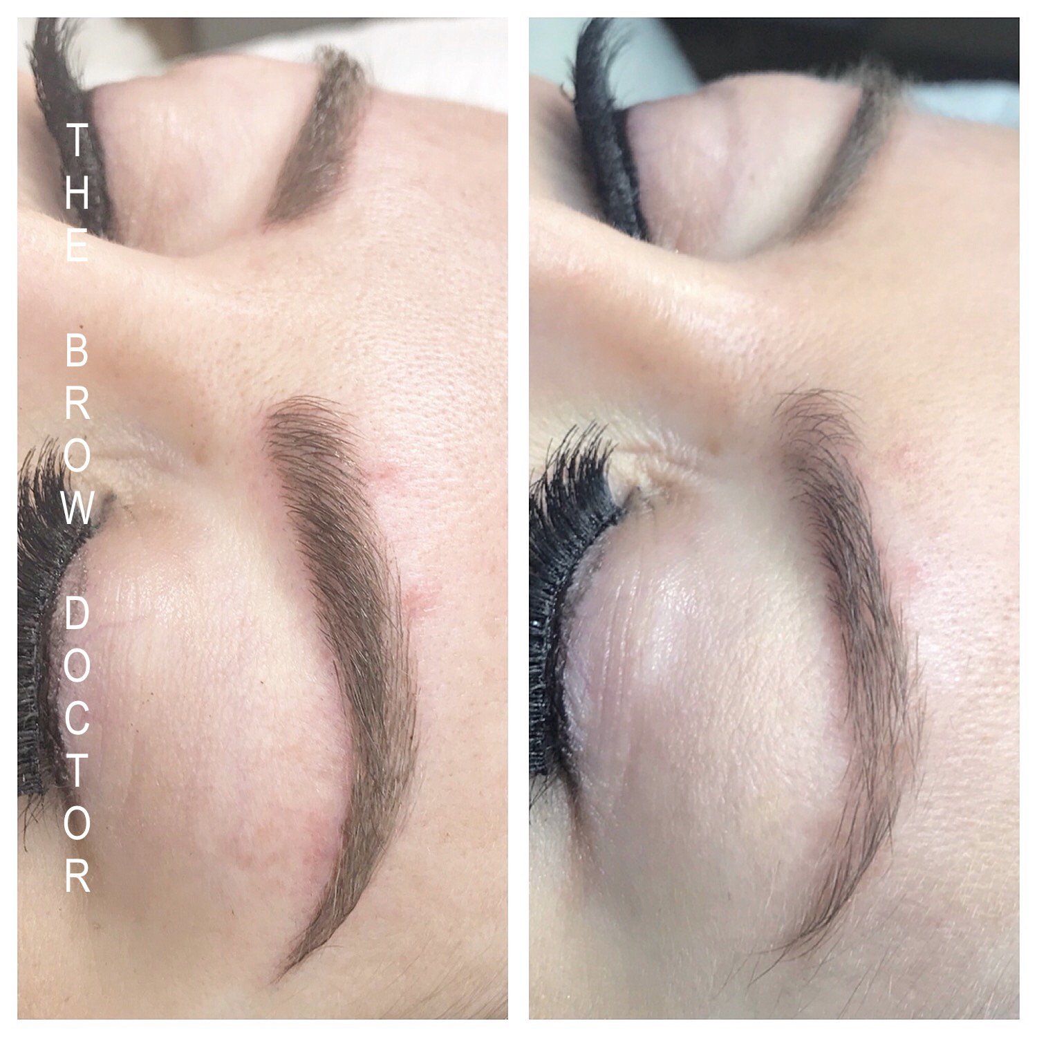 Before and After