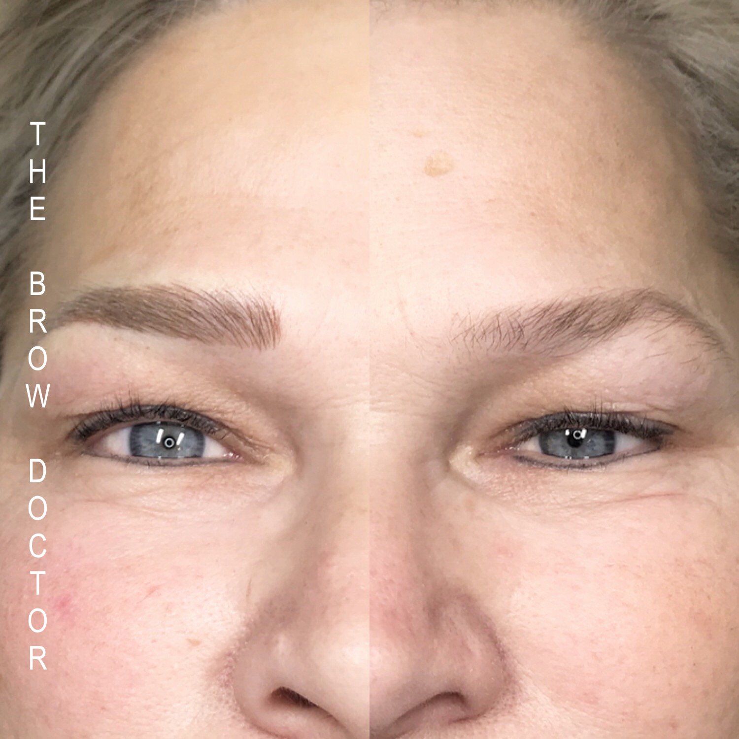 Before and After