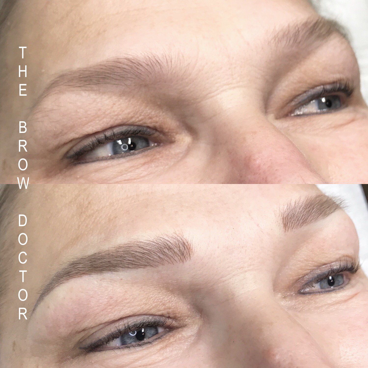 Before and After