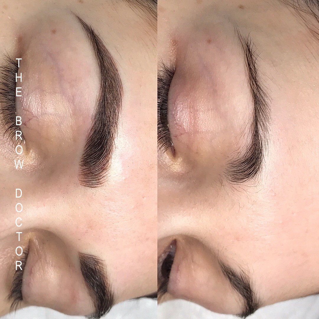 Before and After