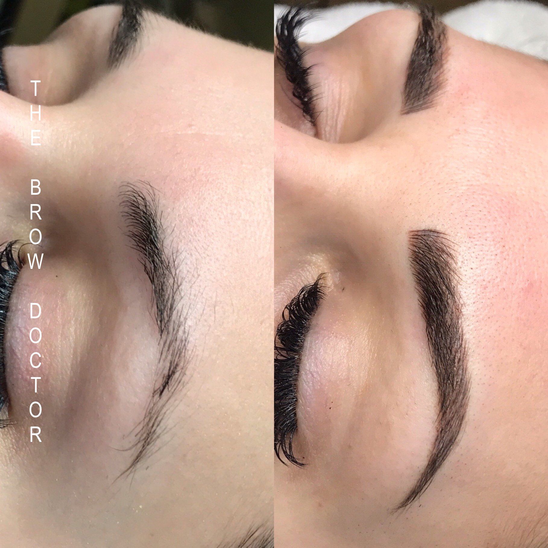 Before and After