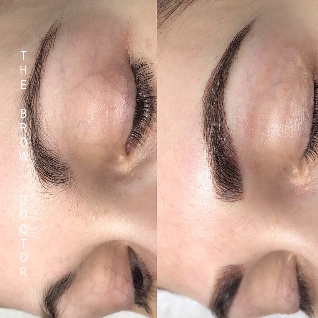 Before and After