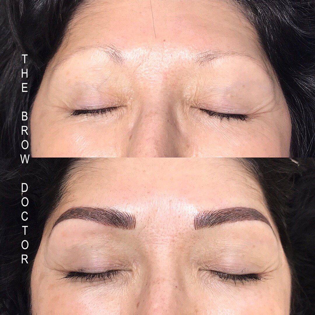 Before and After