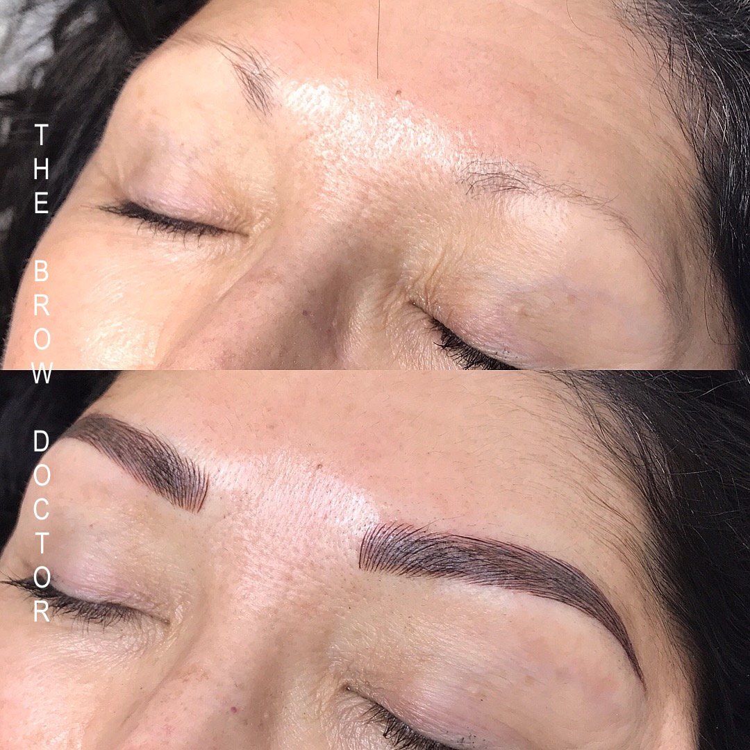 Before and After