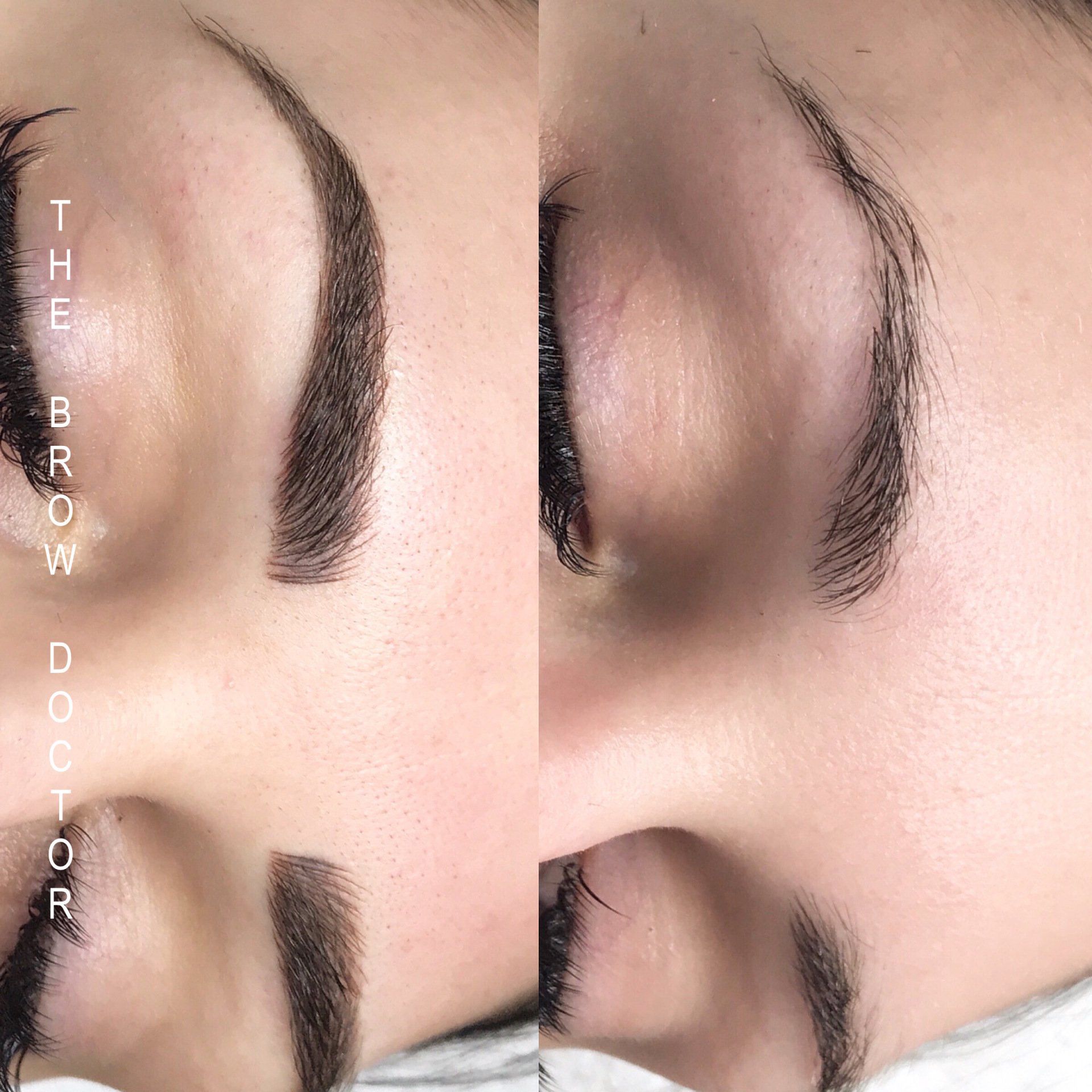 Before and After