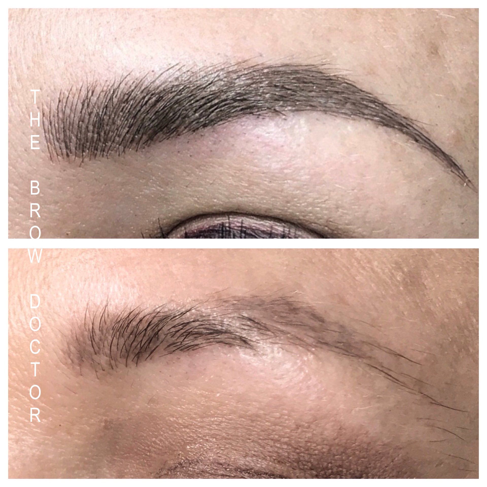 Before and After