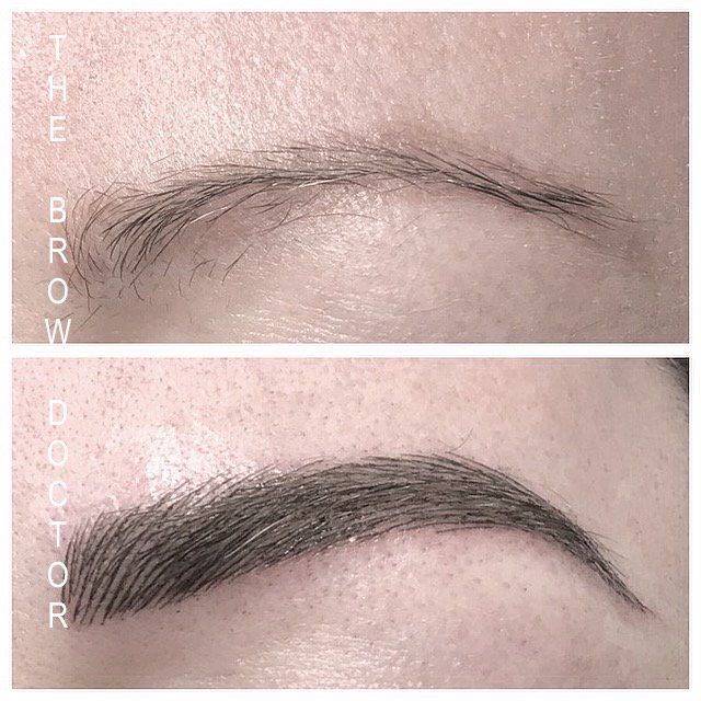 Before and After
