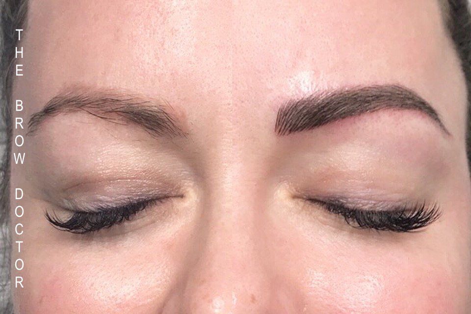 Before and After