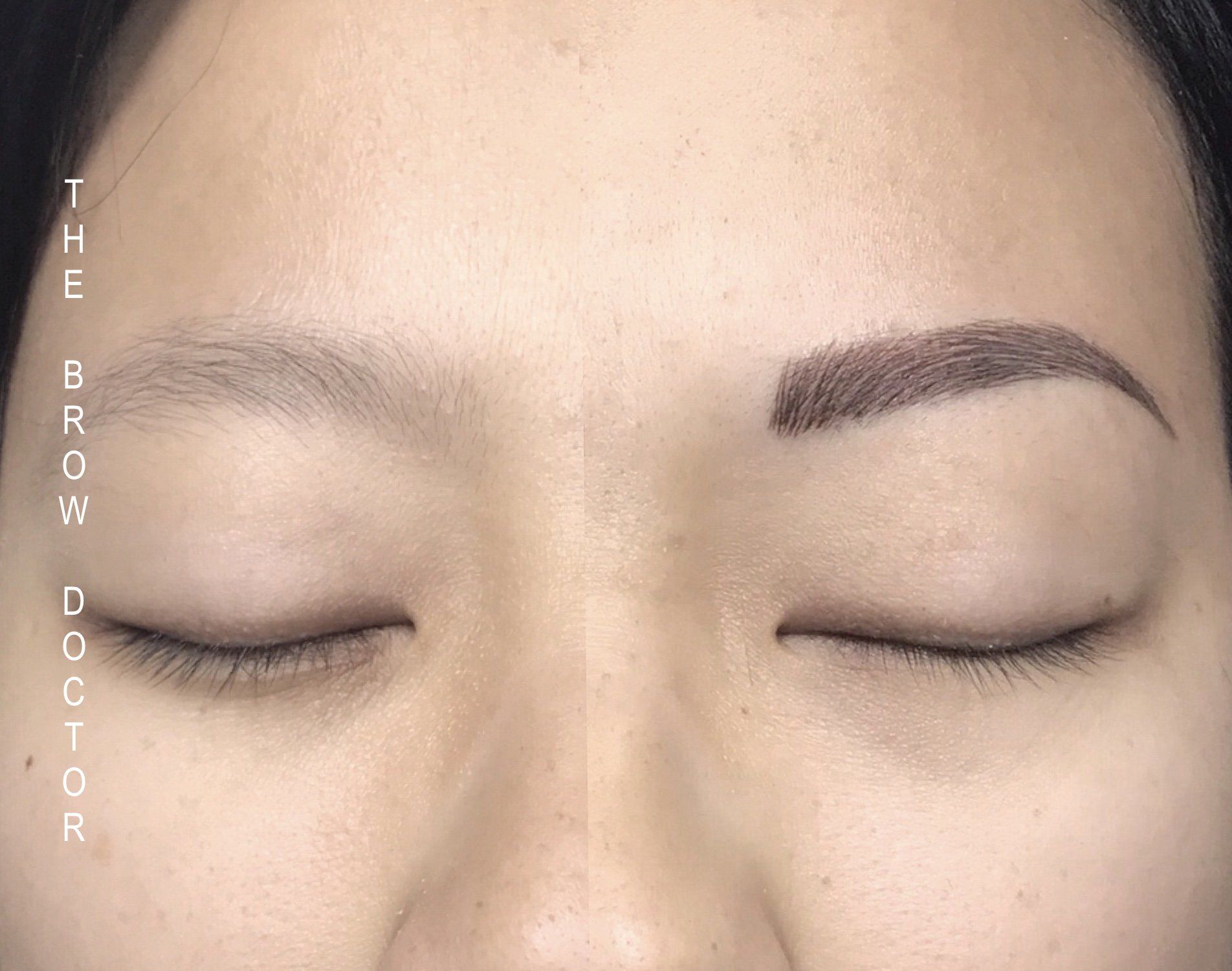 Before and After