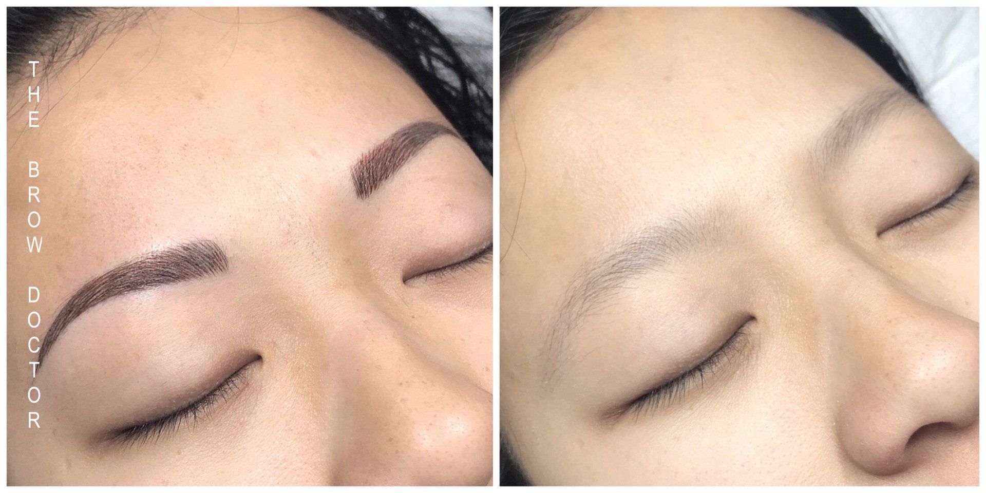 Before and After