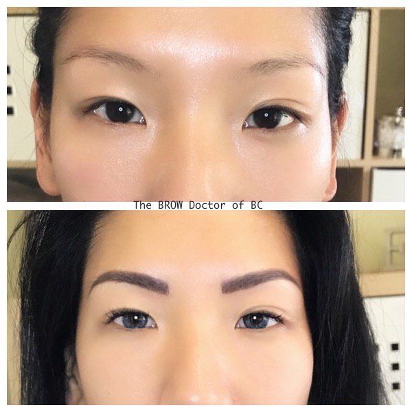 Before and After MicroBlading 