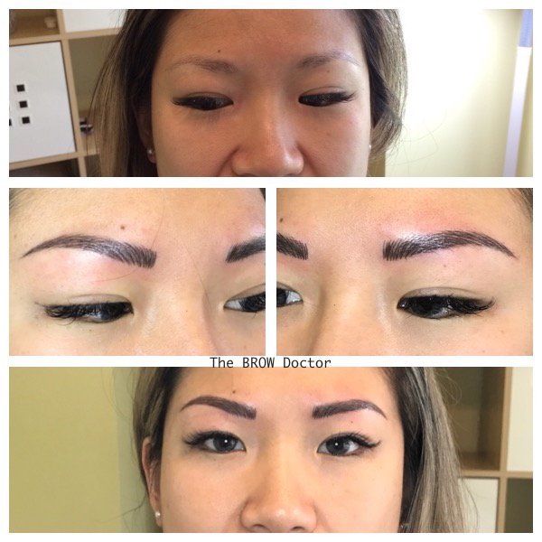 Before and After Micro-Blading 