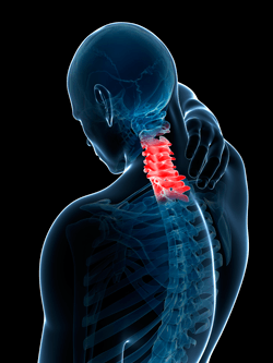 Spine X-Ray — Webster, TX — Ian J Reynolds MD F.A.A.O.S. Spine X-Ray — Webster, TX — Ian J Reynolds MD F.A.A.O.S.