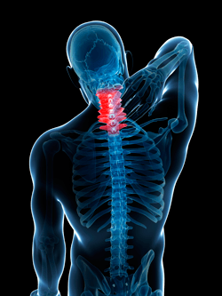 Upper Spine X-Ray — Webster, TX — Ian J Reynolds MD F.A.A.O.S.