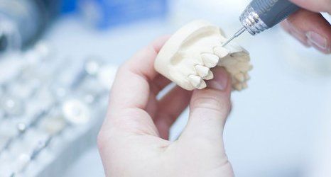 dental implants