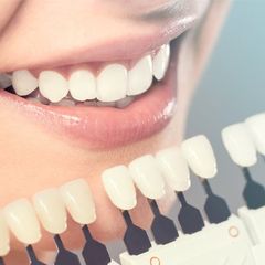 Cosmetic Dentistry — Perfect White Teeth in Modesto, CA Cosmetic Dentistry — Perfect White Teeth in Modesto, CA