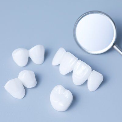 Porcelain Crowns — Veneers in Modesto, CA Porcelain Crowns — Veneers in Modesto, CA