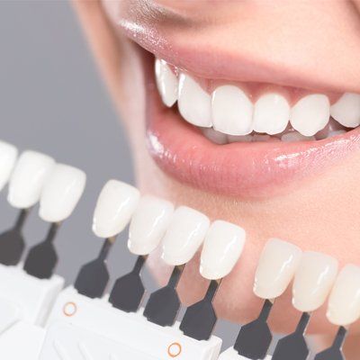 Yellow Teeth — White Teeth in Modesto, CA Yellow Teeth — White Teeth in Modesto, CA