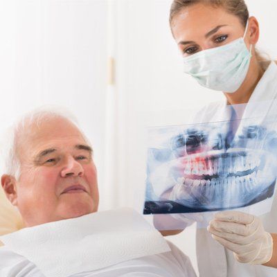 Damaged Teeth — Elder Implant Xray in Modesto, CA Damaged Teeth — Elder Implant Xray in Modesto, CA