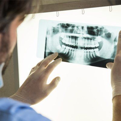 Secure Fit — Xray Result in Modesto, CA Secure Fit — Xray Result in Modesto, CA