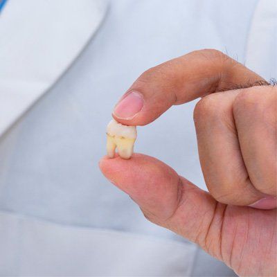 X-Rays — Tooth Holding in Modesto, CA