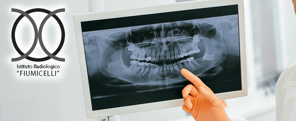 panoramica dentale