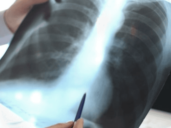 ISTITUTO RADIOLOGICO FIUMICELLI ISTITUTO RADIOLOGICO FIUMICELLI