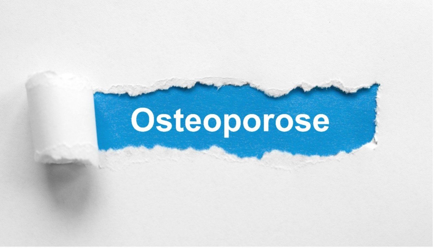 Osteoporose im Kiefer – Ursachen und Prävention