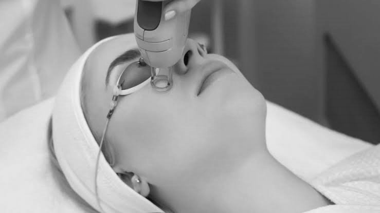 A woman is getting a laser treatment on her face.