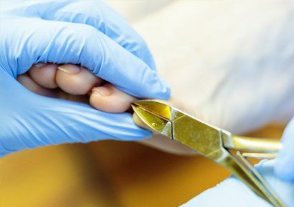 damaged nail being treated