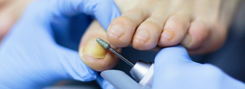 nail care