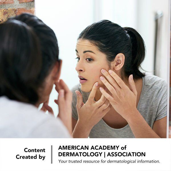 Clear Up Acne