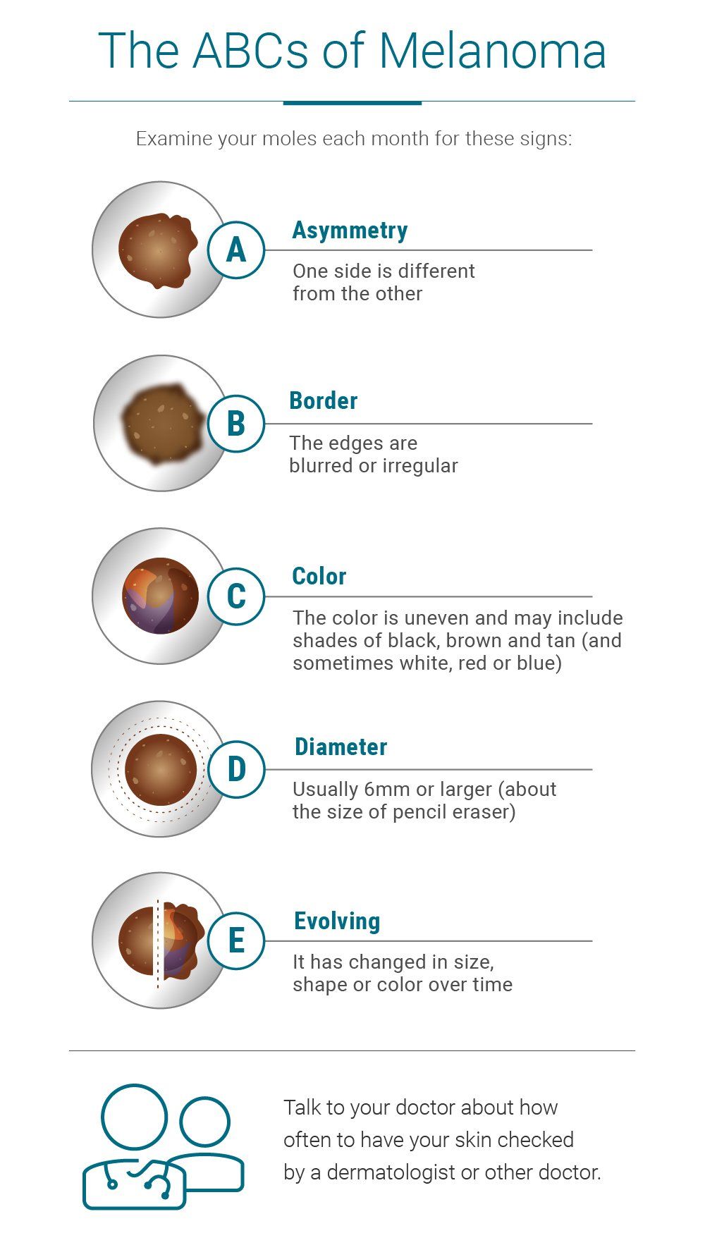 The ABCs of Melanoma