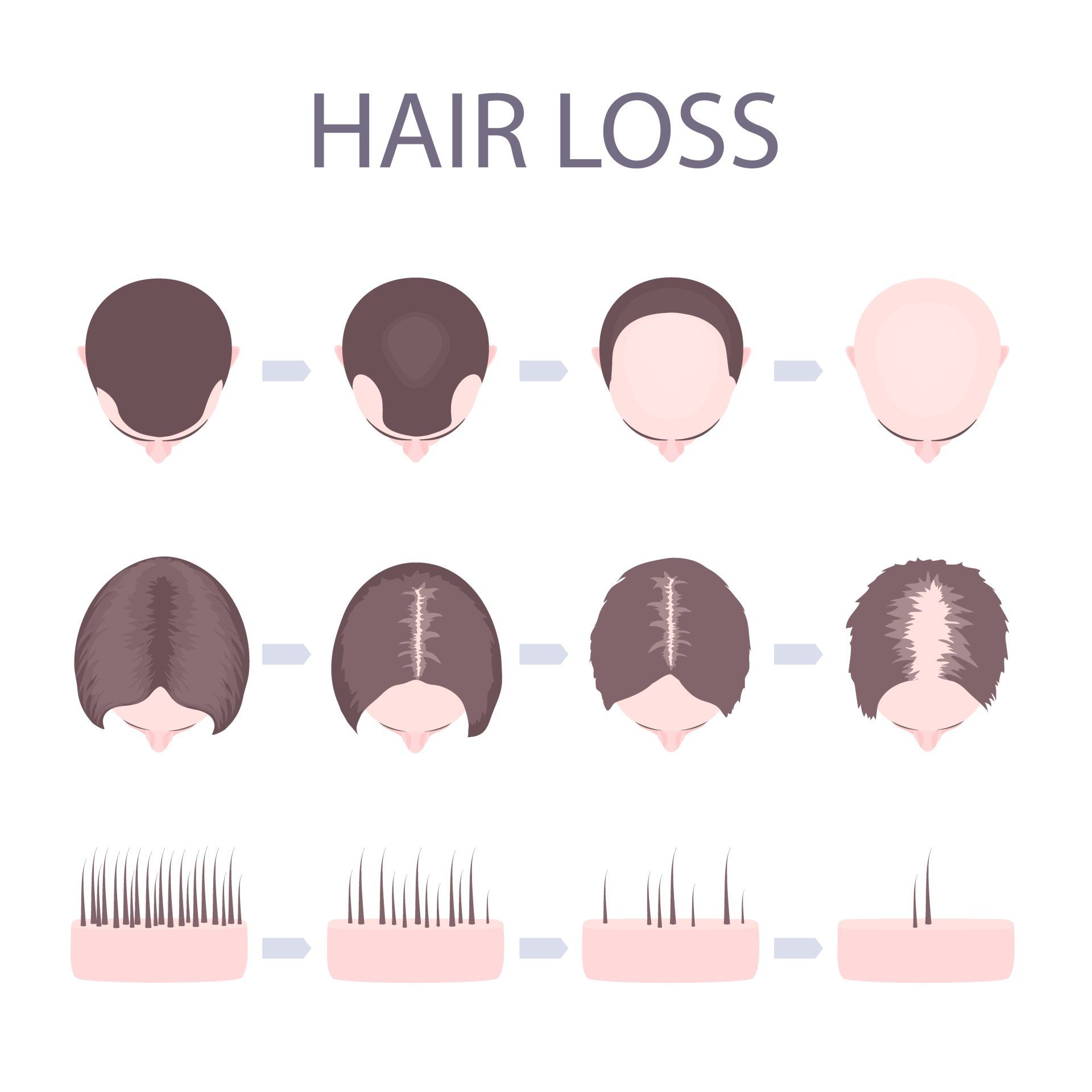 Hair Loss