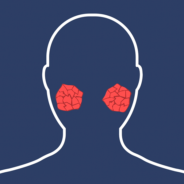 WHAT IS ROSACEA?