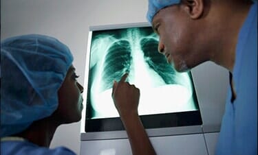Examining Lung — Lung Cancer in Boston Heights, OH Examining Lung — Lung Cancer in Boston Heights, OH