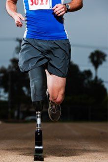 artificial limb services artificial limb services