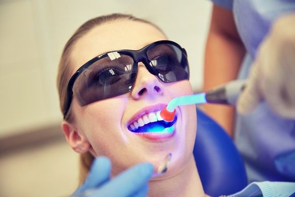 Sbiancamento dentale