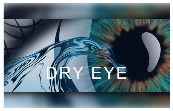 dry eye