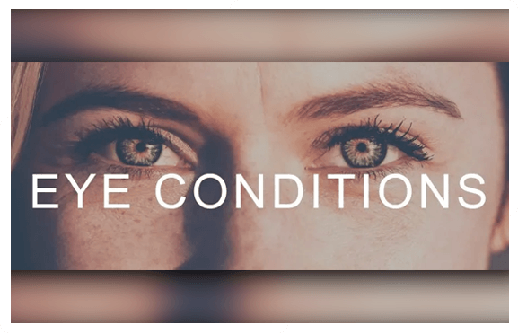 eye condition