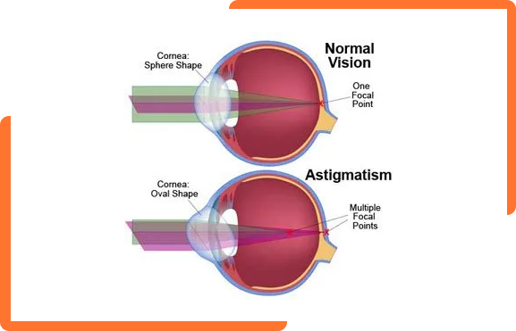 inner eye