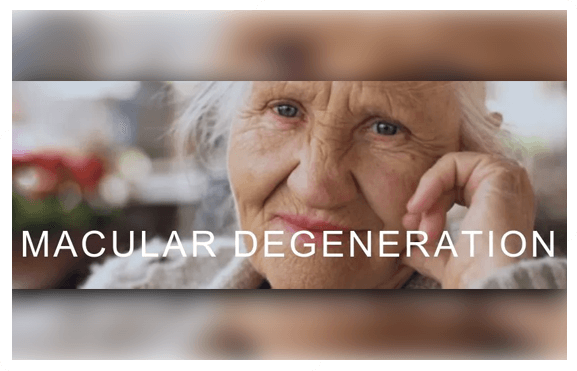 macular degenaration